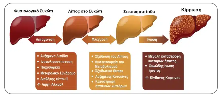 exelixi lipodoys diithisis